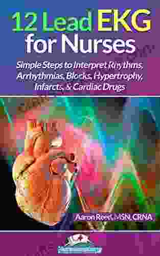 12 Lead EKG For Nurses: Simple Steps To Interpret Rhythms Arrhythmias Blocks Hypertrophy Infarcts Cardiac Drugs
